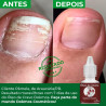 leo De Cravo E Melaleuca Dokmos Unha Fraca Quebradia