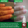leo De Cravo E Melaleuca Dokmos Unha Fraca Quebradia
