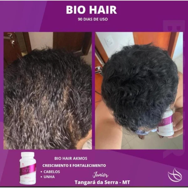 Akbeauty Biohair Akmos Suplemento D Biotina para   Cabelo Pele Unha 60 cápsulas - Imagem 5