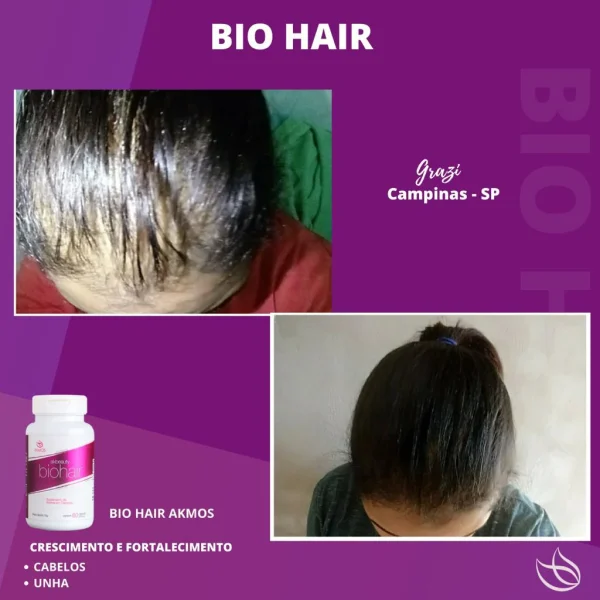 Akbeauty Biohair Akmos Suplemento D Biotina para   Cabelo Pele Unha 60 cápsulas - Imagem 8